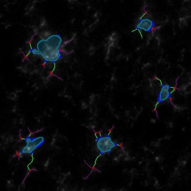 EBER ISH EBER ISHcells 274x274